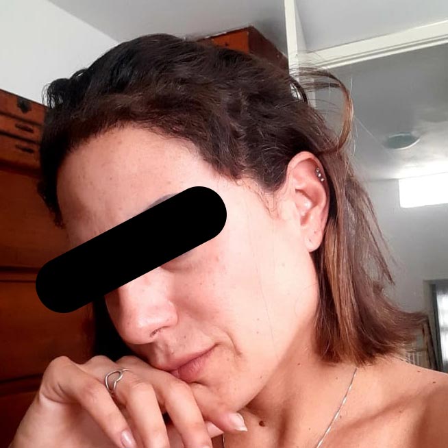 eliminacao-de-falha-no-cabelo-feminino